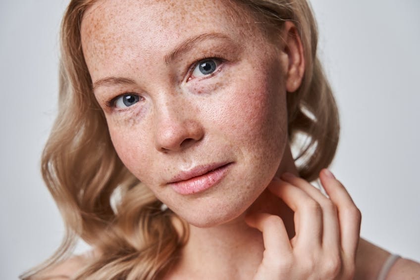 Elevate Your Skin Health with Curcumin Elevate Your Skin Health with Curcumin